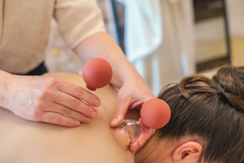 Susan Mehr schröpft den Nackenbereich einer auf dem Rücken liegenden Kundin während der Schröpfmassage