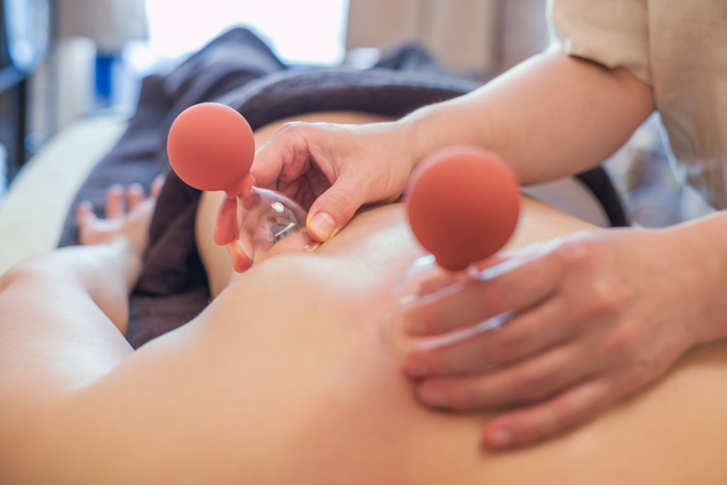 Susan Mehr schröpft das Schulterblatt und die Taille einer Kundin während der Schröpfmassage