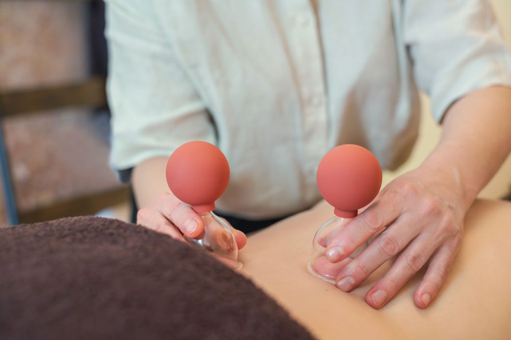 Susan Mehr schröpft den unteren Rücken einer Kundin während der Schröpfmassage